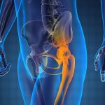 Effective Ways to Improve Your Bones Health Effective Ways to Improve Your Bones Health